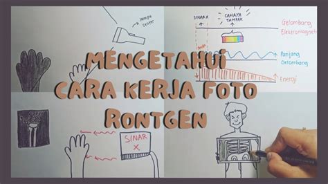 Bagaimana Cara Kerja Foto Rontgen Gigi?