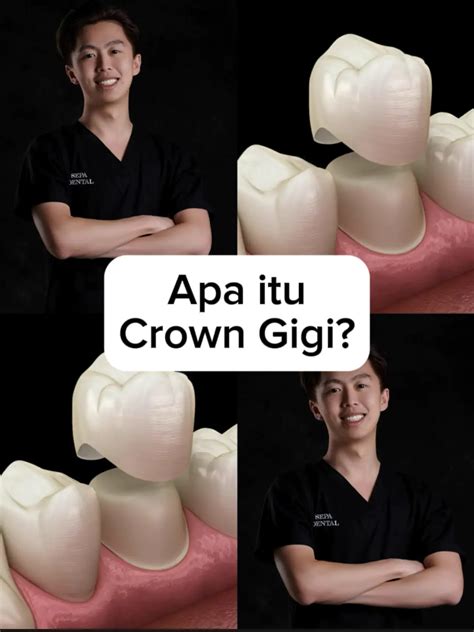 Apa Itu FX Crown?