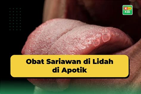 what is sariawan