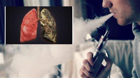 Tips Mencegah Penyakit Vape