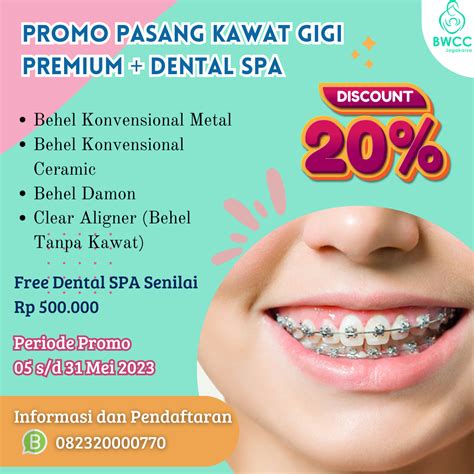 Harga Pasang Aksesoris Gigi di Indonesia